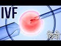 How IVF works? IVF Procedure in hindi आईवीएफ के बारे में देखें ये वीडियो | Pregnancy Gyan