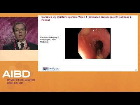 How a sliding hiatus hernia forms. 