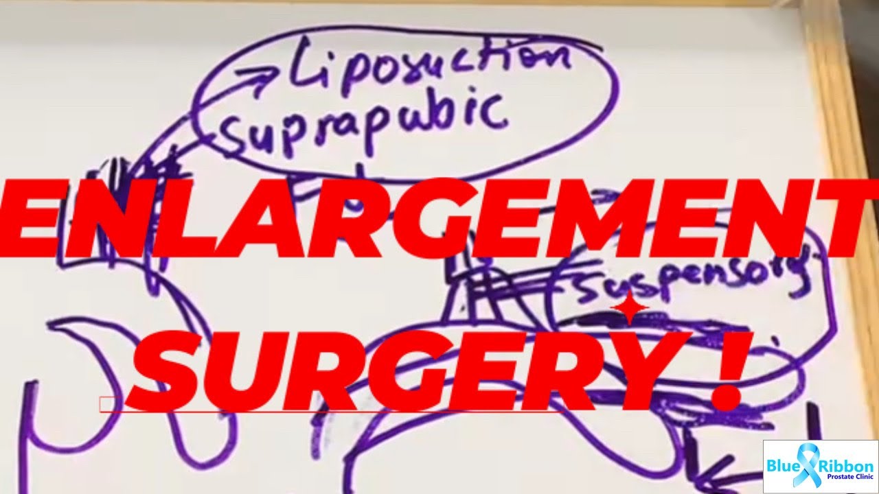 Penile enlargement surgery for small size