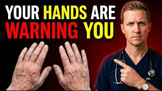 Doctor Warns: 9 Warning Signs in Your Hands and Feet You Should Never Ignore — Could Mean Diabetes