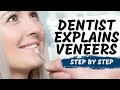 Porcelain Veneers Procedure Explained