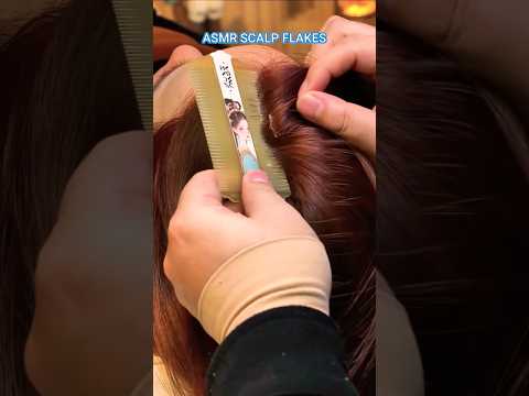 Asmr Scalp Flakes Scalptreatment Scalpcare Scalppsoriasis Scalpmassage LiziASMR