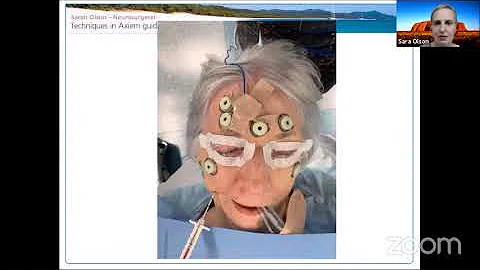 Techniques in Percutaneous Procedures for Trigemin...