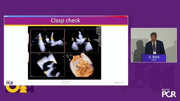 From innovation to integration: evolution of 4D intracardiac echocardiography - EuroPCR 2025