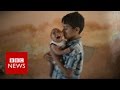 Brazil zika outbreak what is happening to brazils babies bbc news