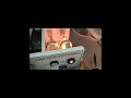 ENT Light Source  Transformer Replacement