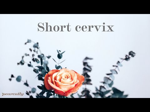 What is a short cervix in pregnancy?