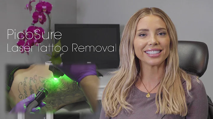 Jamie Stone's Tattoo Removal Experience at Rejuva ...