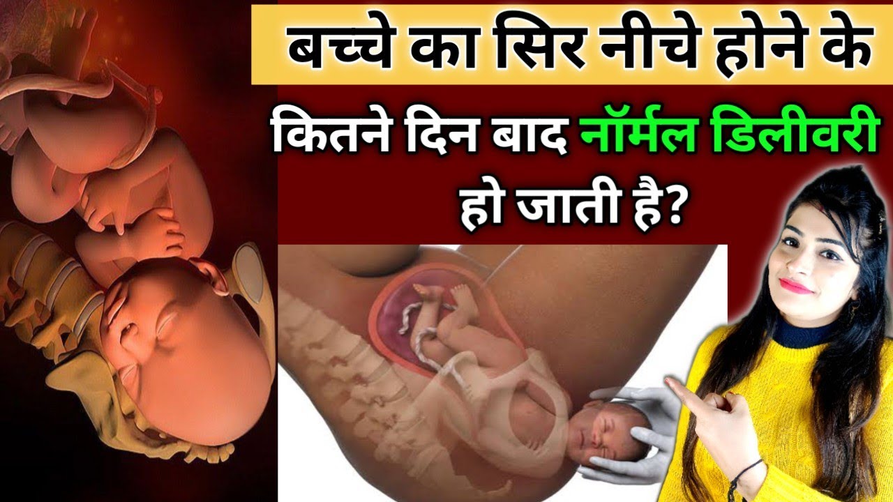 baby-head-down-position-baby-dropping-cephalic-position-of-baby