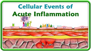 3. Cellular events of Acute Inflammation ( Animation )