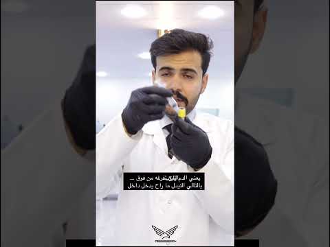 حل المشكلة الثانية من تفريغ الدم في الانابيب بعد سحب الدم من المريض تحليلات مرضية مختبرات 