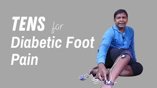 Using TENS for Diabetic Neuropathy, pad placement 