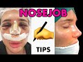 Things You should know BEFORE getting a RHINOPLASTY (NOSE JOB) 👃 Part 2
