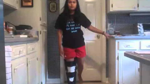 Two Weeks Post-Op ACL and Meniscus