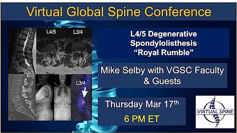 "L4/L5 Degenerative Spondylolisthesi...  'Royal Ru...