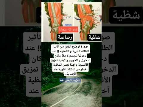صورة توضح الفرق بين تأثير الطلقة النارية و الشظية عند دخوله  حقائق