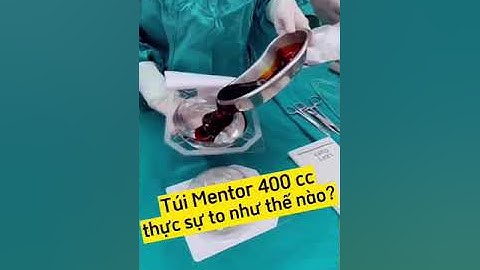 Cận cảnh kích cỡ túi Mentor 400cc