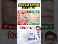 pimples ke liye acnestar soap kaise kam karti hai #trending #pimpleproblem #shorts