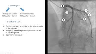 Basic Left Coronary Angio Views
