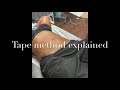 Tape method: how long to leave it on & how to remove it