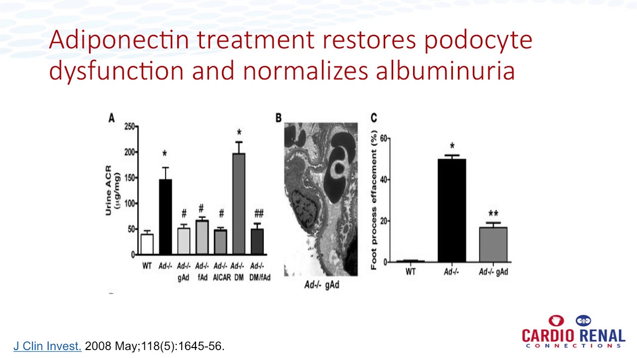 proteinuria hipertóniával