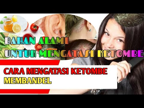 Cara menghilangkan ketombe membandel dan gatal agar rambut bersih pakai