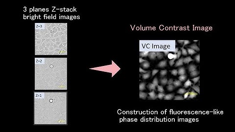 Cell proliferation and Apoptosis assay of HeLa live cell high content analysis using volume contrast
