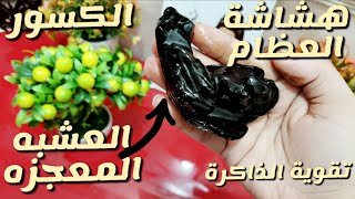 تخلصي من هشاشة العظام في خلال شهر واحد فقط