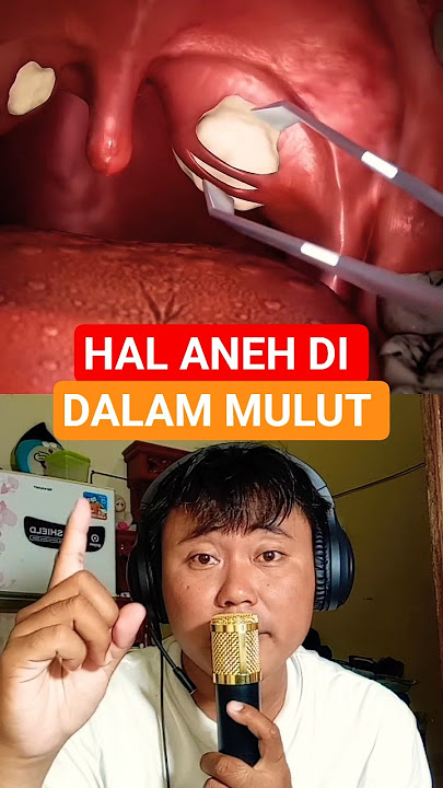 White things growing in the mouth😳 #facts #dentist #didyouknow #science #orthodontist