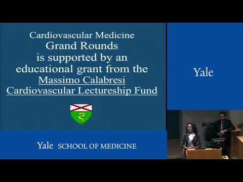 Acute Mechanical Circulatory Support for Cardiogenic Shock
