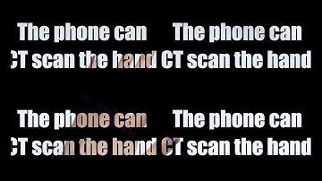 The phone can CT scan the hand, A phone can be a CT scanning machine, unbelievable!!!