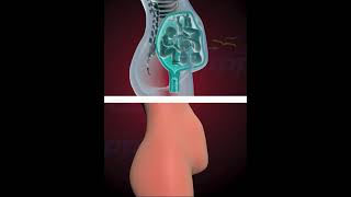 PRECIOUS MOMENTS OF TRIPLETS INSIDE THE WOMB (3D ANIMATION)