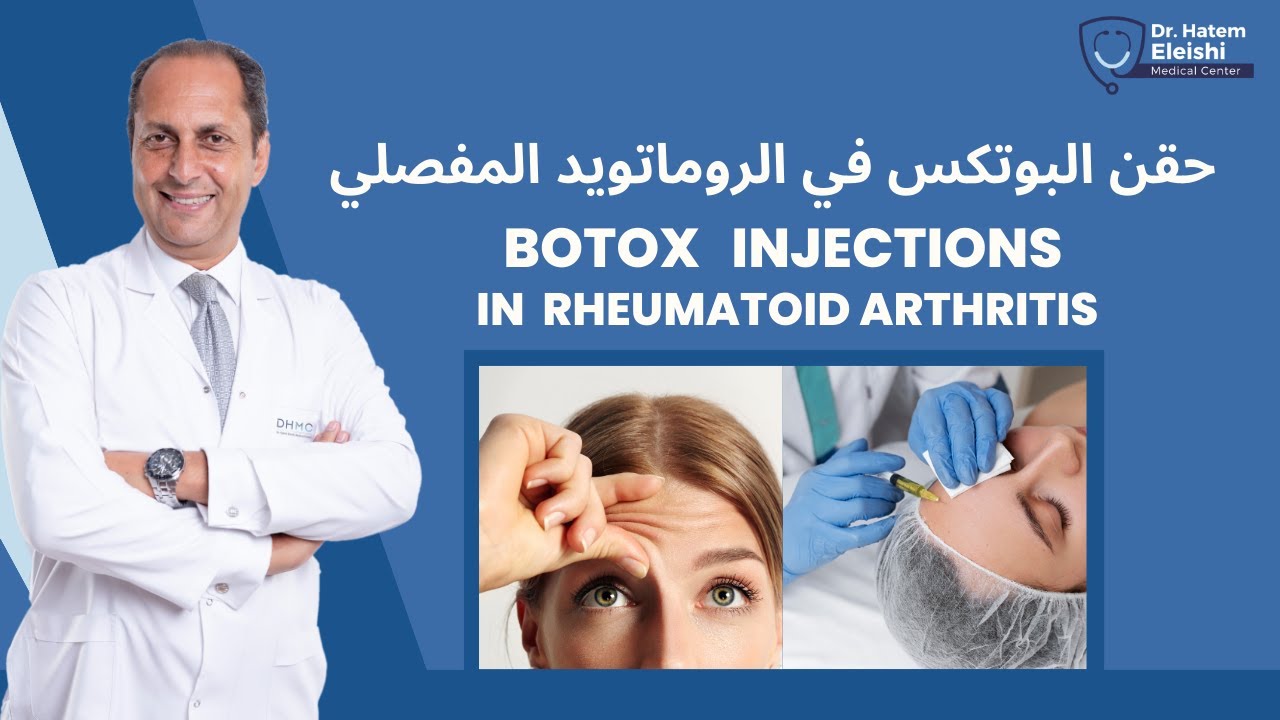 حقن البوتوكس والروماتويد المفصلي. عندي روماتويد. ينفع احقن بوتوكس؟ أ.د. حاتم العيشي