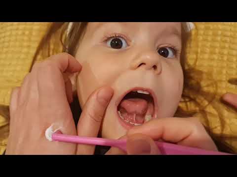 Video: 3 būdai sužinoti, ar jūsų vaikas turi skarlatinos karščiavimą