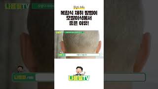 모발이식 방법 고민 중이세요? 해답 드립니다 - 피부과 전문의 추천 이식 방법 #광주모발이식 #광주탈모치료