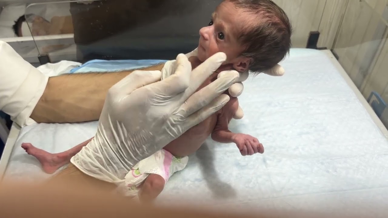 Physiotherapy for a Little Fighter 💪👶 | Gentle Care in the NICU