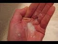التهابات المهبل بالفطريات اسباب وعلاج د محمد جاد Vaginal Thrush الصحة الجنسية التهابات المهبل بالفطريات اسباب وعلاج د محمد جاد Vaginal Thrush الصحة الجنسية