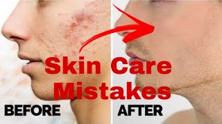 Things that are damaging your skin | Skin care routine for men