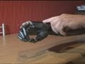 Bionic hand gives a new lease of life