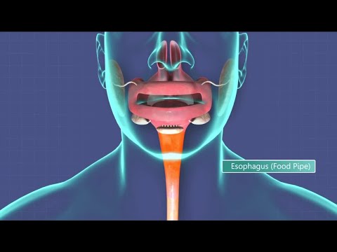 वीडियो: एसोफैगल कैंसर का निदान और उपचार कैसे करें (चित्रों के साथ)