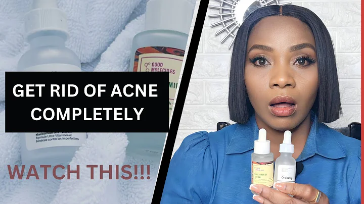 How to Get Rid of Acne Completely || Benefits Of Using Niacinamide  Serum