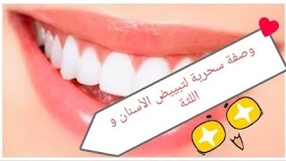 وصفة اكثر من رائعة #تبييض_الأسنان و #اسمرار_اللثة  جربوها و مغتندموش??