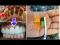 How to Whiten Teeth at Home Fast and Safe in മലയാളം  || Natural Remedy to Whiten Teeth Malayalam