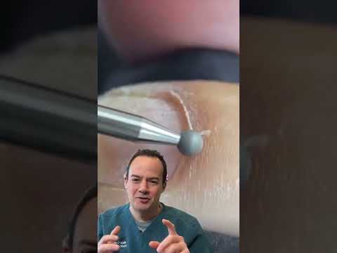वीडियो: क्यूटिकल्स को ठीक करने के 3 तरीके