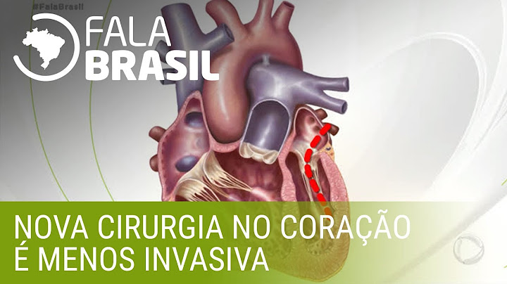 Nova cirurgia no coração é menos invasiva