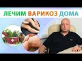 Как вылечить варикоз? Чего делать нельзя?