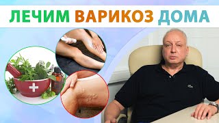 Как вылечить варикоз? Чего делать нельзя?