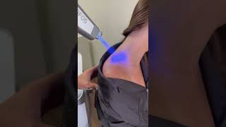 Localized Cryotherapy Cold Therapy With Infrared In Beverly Hills