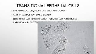 Chapter 7   Microscopic Examination of Urine