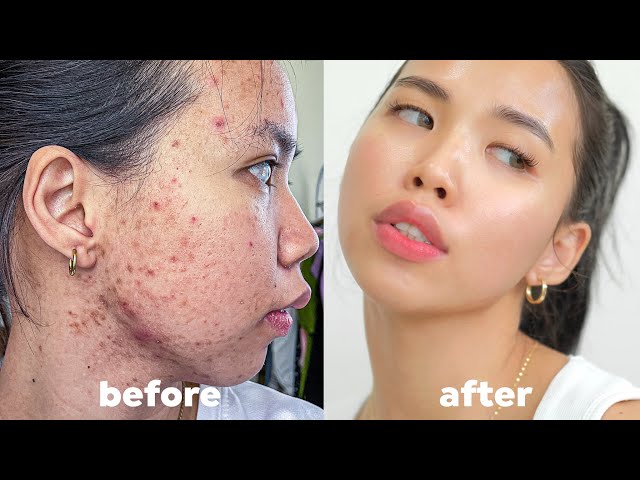 my step-by-step skincare routine (morning & nighttime) class=